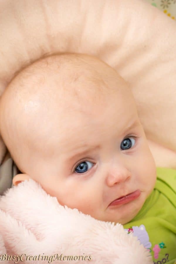 Cradle Cap Remedies that actually work with fast results!